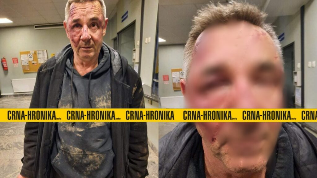 (FOTO) Policija u Tuzli teško pretukla humanistu i demobilisanog borca Armije RBiH Suada Žilića