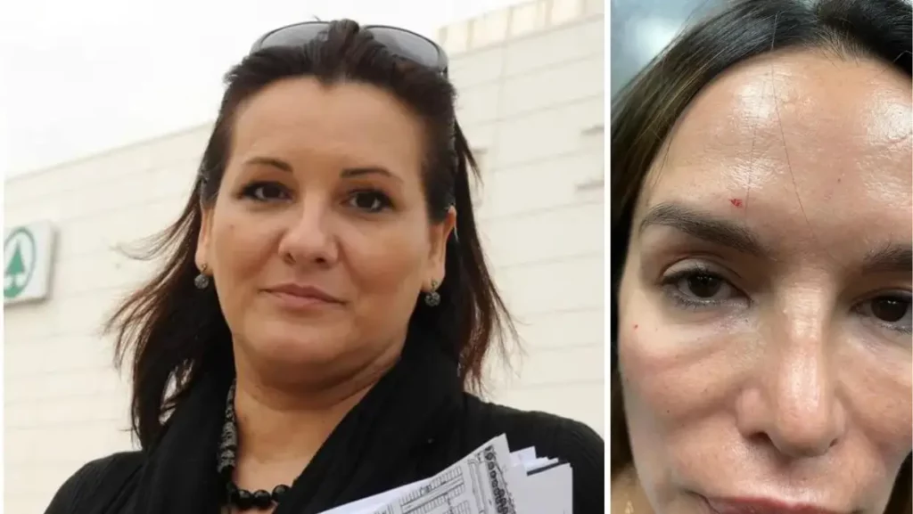 Oglasila se Severinina sestra: ‘Ona je agresivna i mentalno upitna, ubola me oštrim predmetom’