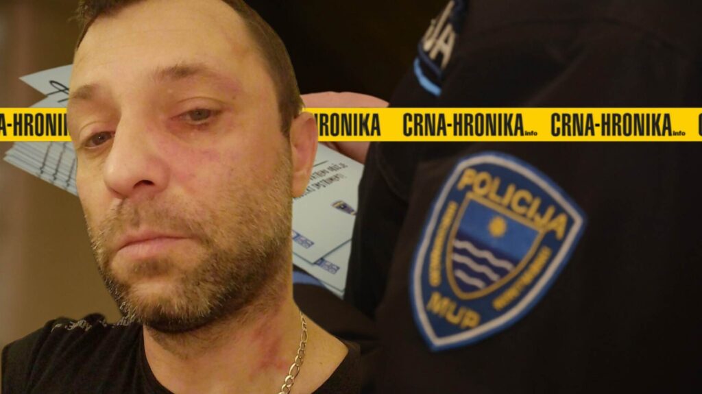 Alen iz Mostara tvrdi da ga je policija greškom pretukla