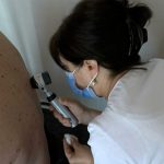 Bosna i Hercegovina nema registar oboljelih od melanoma kože